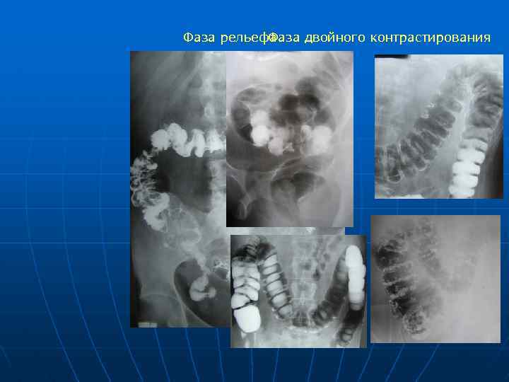 Лучевая диагностика жкт презентация