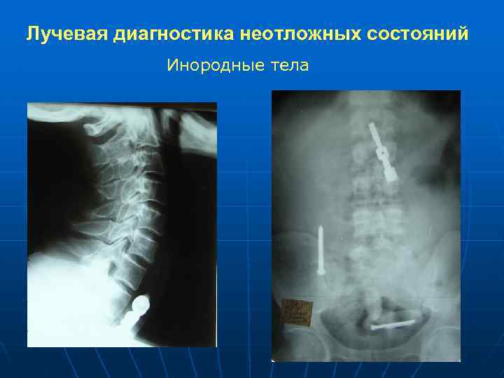 Лучевая диагностика жкт презентация