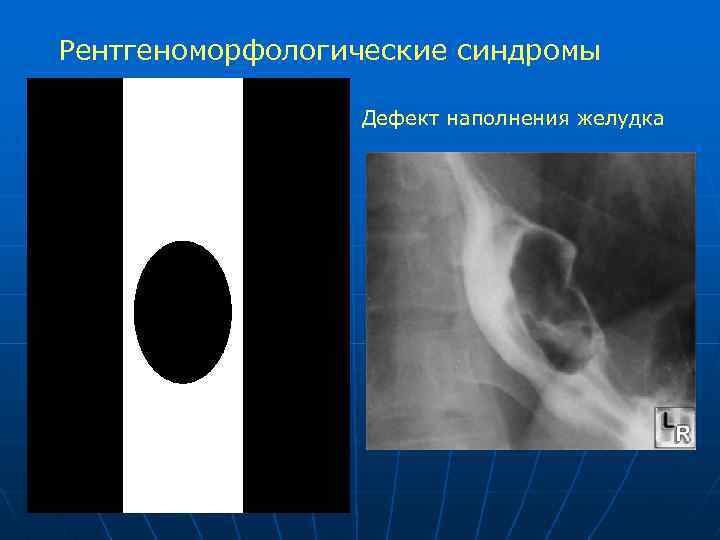 Лучевая диагностика жкт презентация