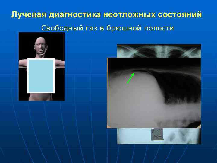 Презентация лучевая диагностика неотложных состояний