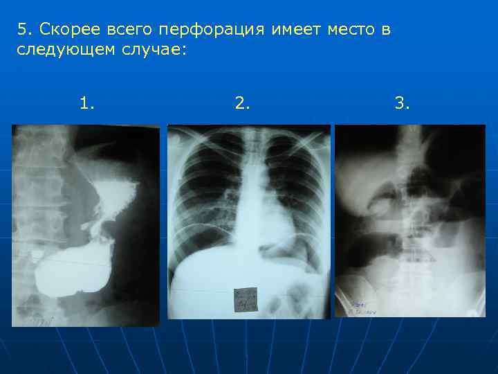 Лучевая диагностика заболеваний жкт презентация