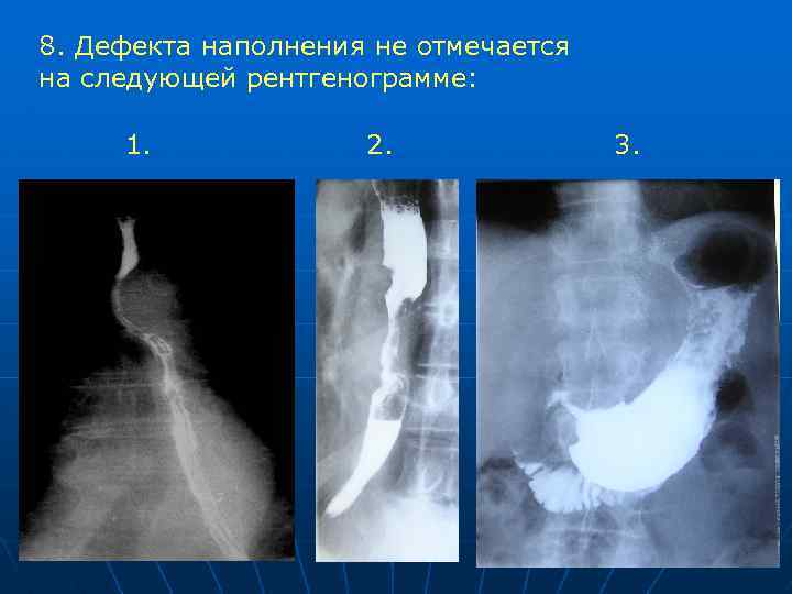 Лучевая диагностика пищевода презентация