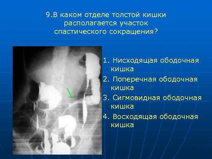 Лучевая диагностика жкт презентация