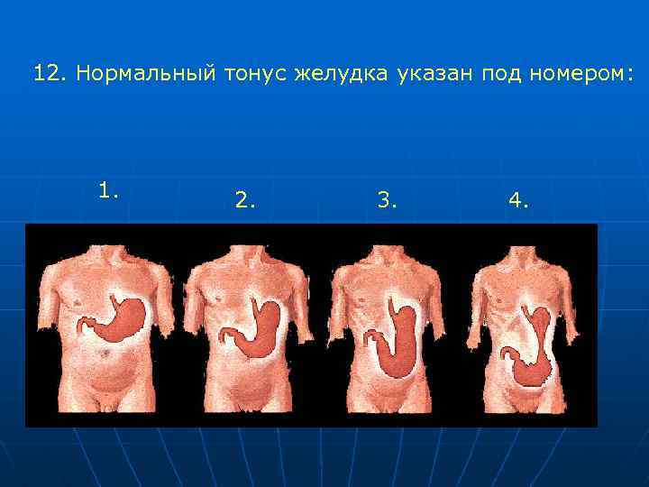 12. Нормальный тонус желудка указан под номером: 1. 2. 3. 4. 