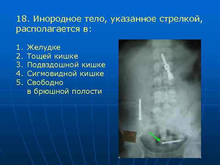 Лучевая диагностика жкт презентация