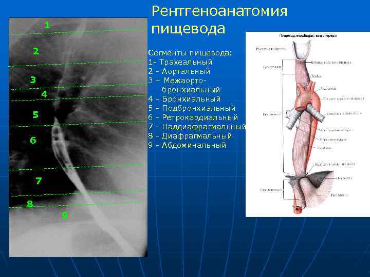 Лучевая диагностика пищевода презентация