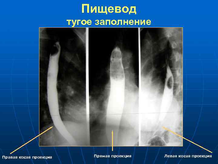 Лучевая диагностика пищевода презентация