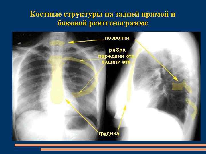Костные структуры на задней прямой и боковой рентгенограмме 