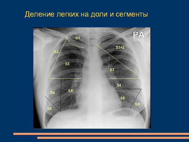 Сегменты легких фото