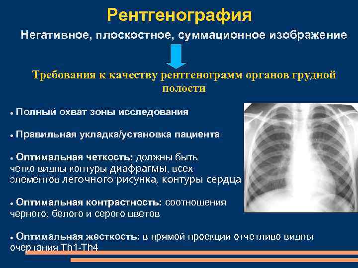 Изображение органов на рентгенограммах является ответ на тест