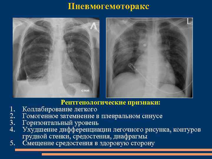 Коллабирование это