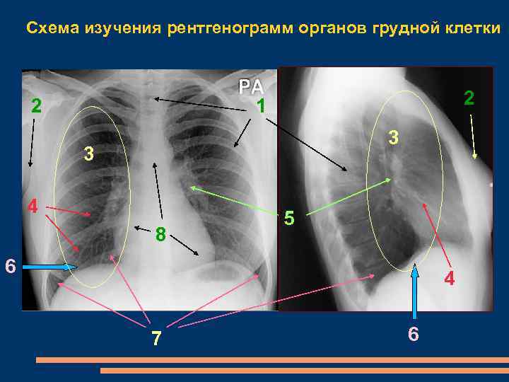 Схема описания рентгенограммы грудной клетки