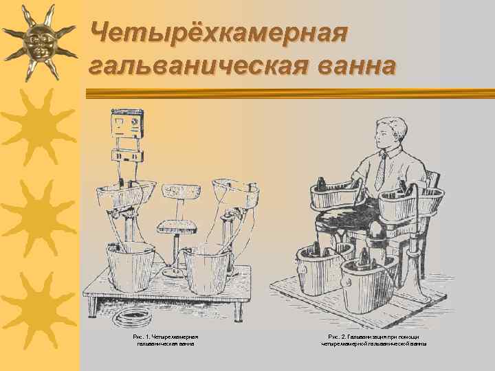 Четырёхкамерная гальваническая ванна Рис. 1. Четырехкамерная гальваническая ванна Рис. 2. Гальванизация при помощи четырехкамерной