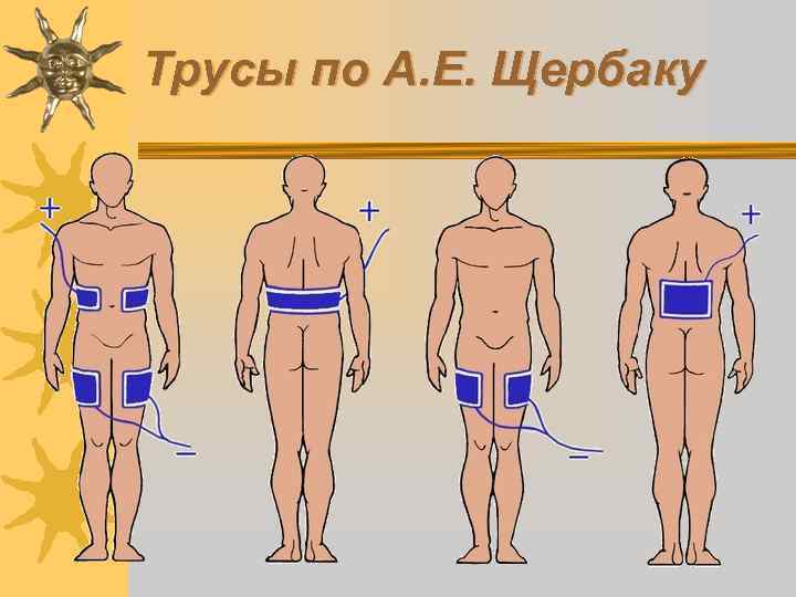 Трусы по А. Е. Щербаку 