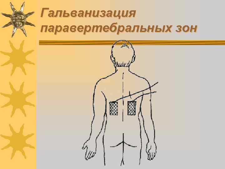 Презентация на тему гальванизация