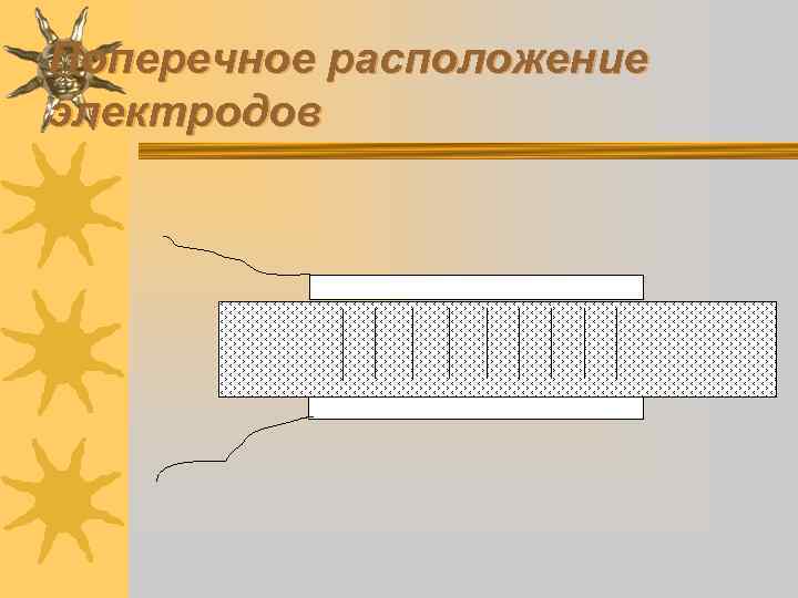 Поперечное расположение электродов 