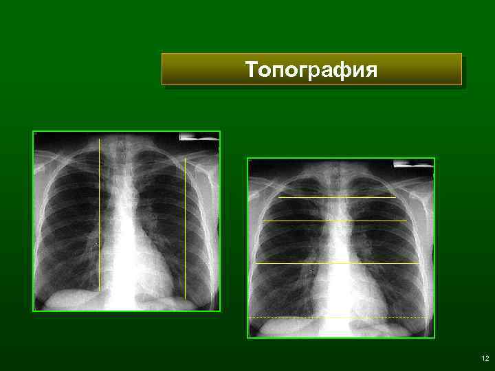 Топография 12 
