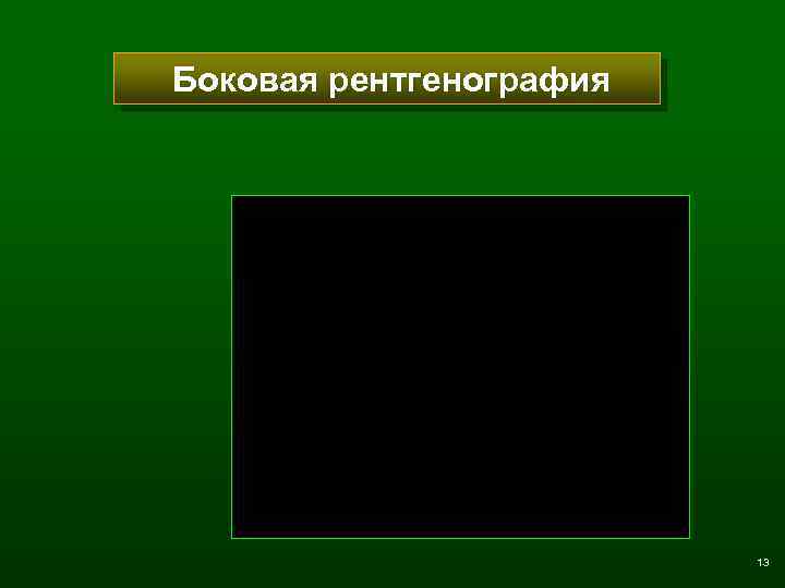 Боковая рентгенография 13 