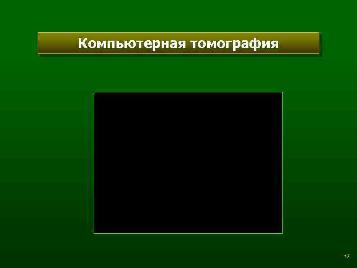 Компьютерная томография 17 