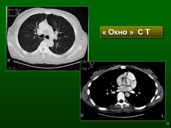  « Окно » С Т 18 