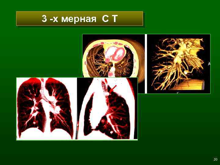 3 -х мерная С Т 20 