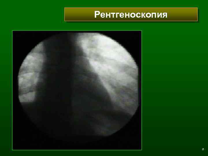 Рентгеноскопия 8 