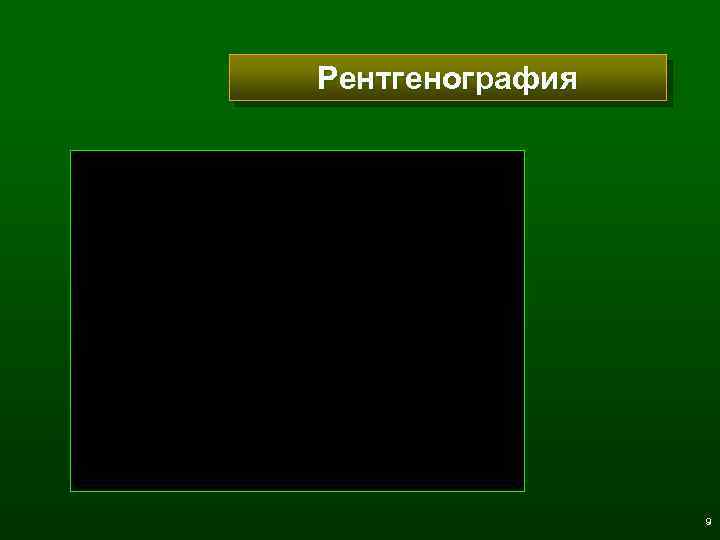Рентгенография 9 