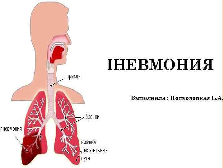 ПНЕВМОНИЯ Выполнила : Подволоцкая Е. А. 