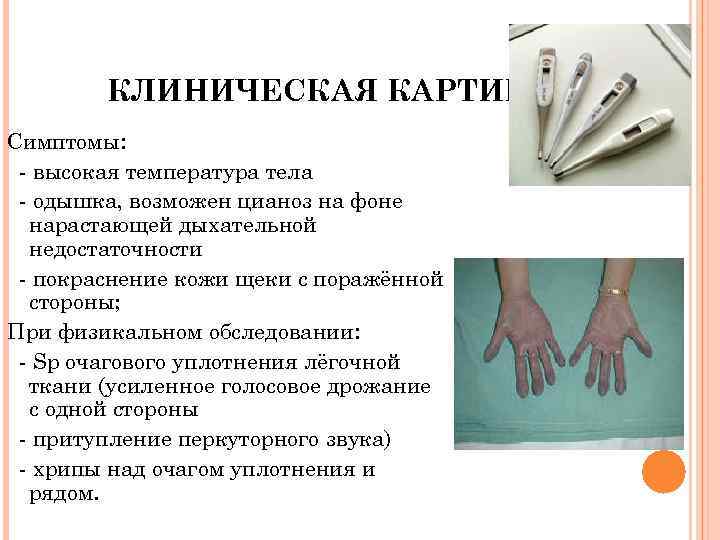 КЛИНИЧЕСКАЯ КАРТИНА Симптомы: - высокая температура тела - одышка, возможен цианоз на фоне нарастающей