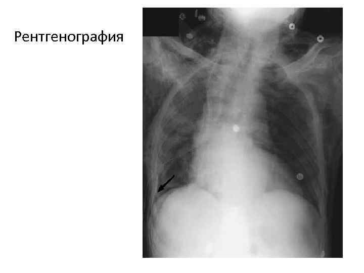 Рентгенография 