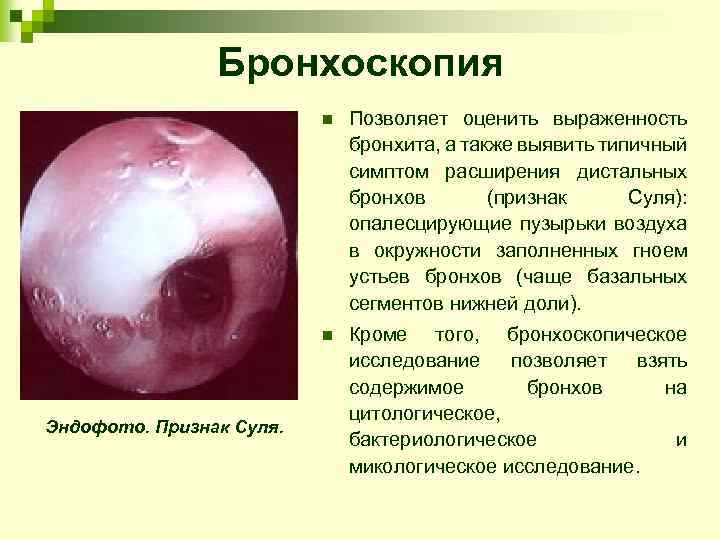 Бронхоскопия n n Эндофото. Признак Суля. Позволяет оценить выраженность бронхита, а также выявить типичный