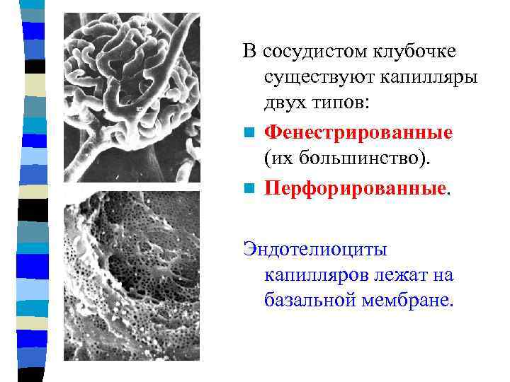 В сосудистом клубочке существуют капилляры двух типов: n Фенестрированные (их большинство). n Перфорированные. Эндотелиоциты
