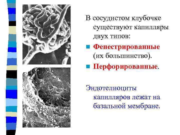 В расщеплении базальной мембраны стенки капилляров располагаются