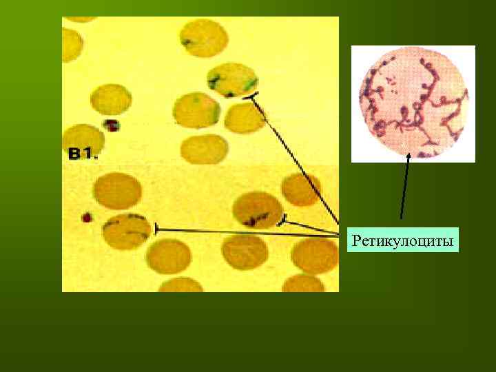 Ретикулоциты 