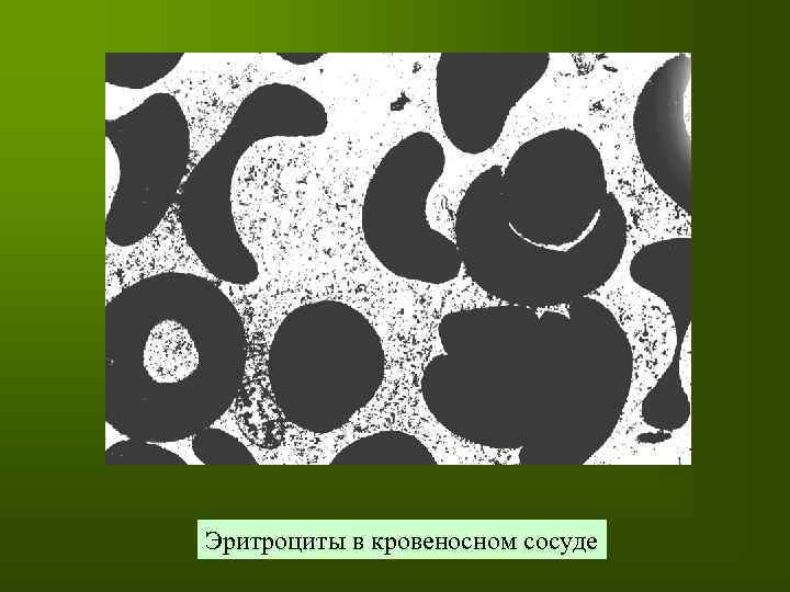 Эритроциты в кровеносном сосуде 