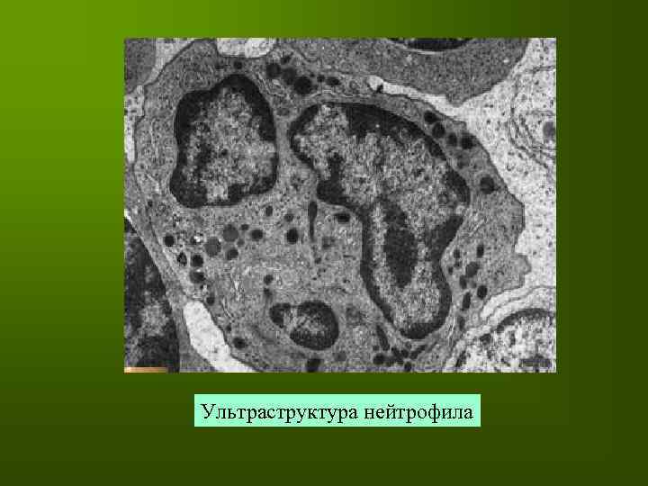 Ультраструктура нейтрофила 