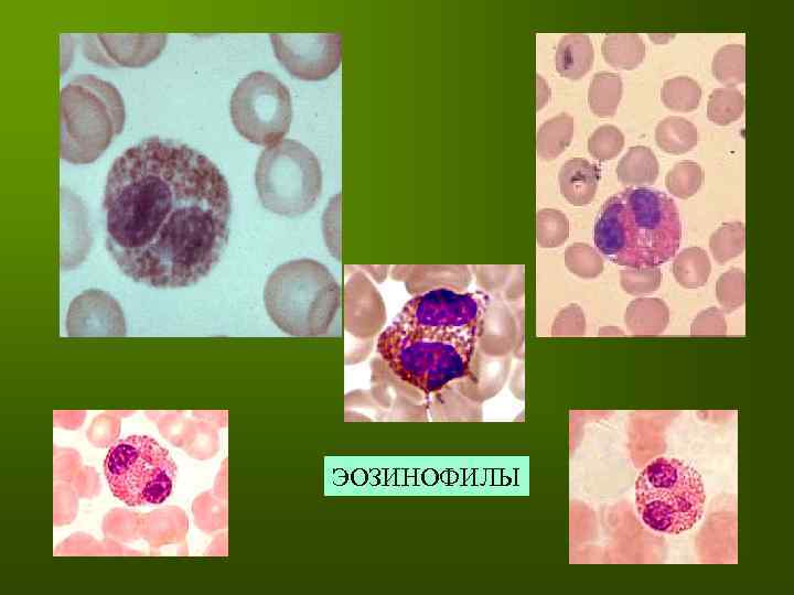 Эозинофилы в общем. Эозинофилы морфология клетки. Клетки соединительной ткани эозинофилы. Эозинофилы строение гистология. Эозинофилы 1.