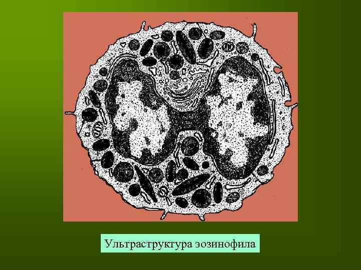 Ядро эозинофила. Ультраструктура эозинофила. Ультраструктура нейтрофильного гранулоцита. Ультраструктура гранул. Эозинофилы строение гранул.