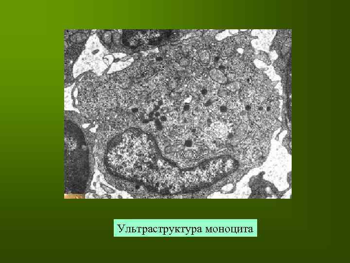 Ультраструктура моноцита 
