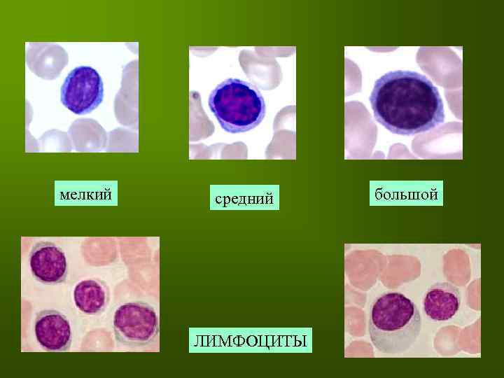 мелкий средний ЛИМФОЦИТЫ большой 
