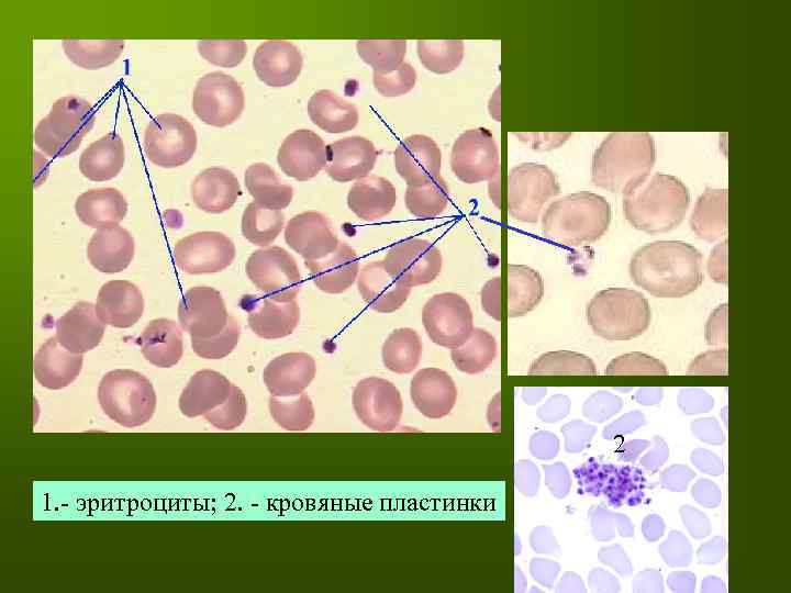 2 1. - эритроциты; 2. - кровяные пластинки 
