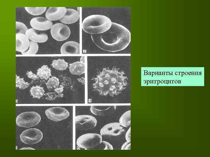 Варианты строения эритроцитов 