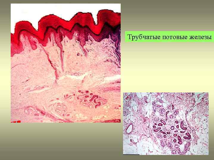 Трубчатые потовые железы 