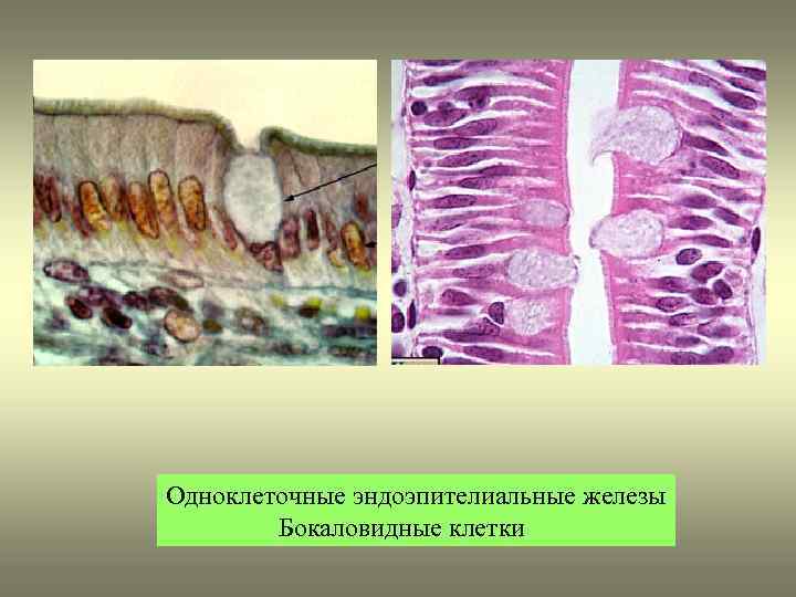 Гиперплазированный железистый эпителий на фоне крови