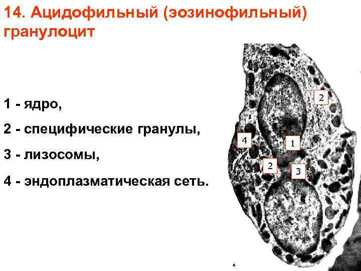 14. Ацидофильный (эозинофильный) гранулоцит 2 1 - ядро, 2 - специфические гранулы, 3 -