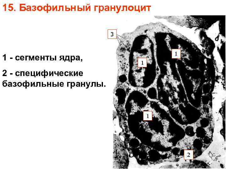 15. Базофильный гранулоцит 3 1 - сегменты ядра, 1 1 2 - специфические базофильные