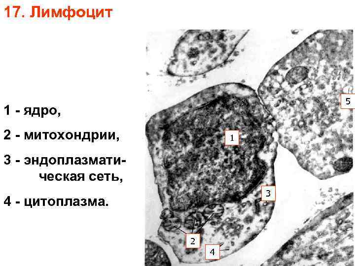 17. Лимфоцит 5 1 - ядро, 2 - митохондрии, 1 3 - эндоплазматическая сеть,