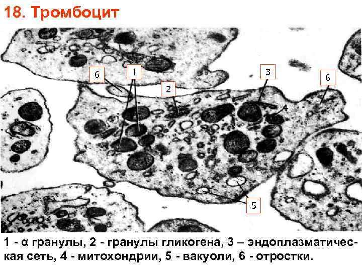 18. Тромбоцит 6 1 3 6 2 5 1 - α гранулы, 2 -