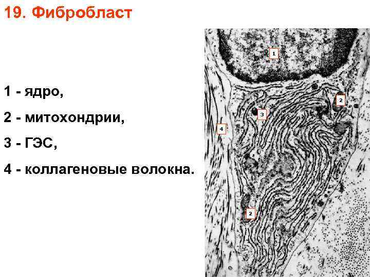 19. Фибробласт 1 1 - ядро, 2 2 - митохондрии, 3 4 3 -