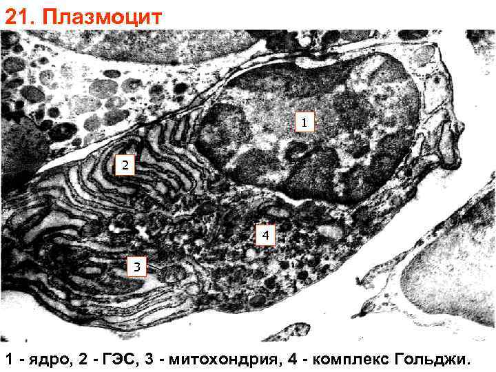 21. Плазмоцит 1 2 4 3 1 - ядро, 2 - ГЭС, 3 -